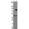 兔抗NBPF19101214151620多克隆抗体