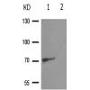 兔抗RACGAP1(Phospho-Ser387) 多克隆抗体