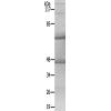 兔抗ICK(Ab-159) 多克隆抗体
