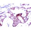 兔抗RELA (Phospho-Ser276) 多克隆抗体 