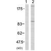 兔抗IGF1R(Phospho-Tyr1161) 多克隆抗体