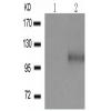 兔抗NFKB1 (Phospho-Ser927)多克隆抗体