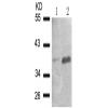 兔抗NFKBIA(Phospho-Ser32 Ser36)多克隆抗体