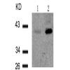 兔抗NFKBIE (Phospho-Ser22)多克隆抗体