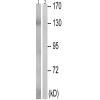 兔抗NOS3(Phospho-Thr494) 多克隆抗体