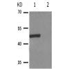 兔抗IKBKG(Phospho-Ser31) 多克隆抗体
