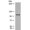 兔抗RNF111多克隆抗体 