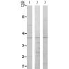 兔抗NR2F6多克隆抗体