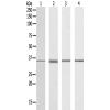 兔抗RNF113B多克隆抗体