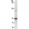 兔抗NR3C1(Ab-211) 多克隆抗体