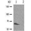 兔抗IL10RA(Phospho-Tyr496) 多克隆抗体
