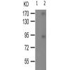 兔抗Rock2(Phospho-Tyr722) 多克隆抗体