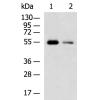 兔抗UGT3A1多克隆抗体