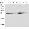 兔抗RPL10A多克隆抗体
