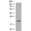 兔抗RPL23A多克隆抗体