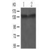 兔抗NTRK1 (Phospho-Ser791)多克隆抗体