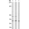 兔抗RPS4Y1多克隆抗体 