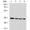 兔抗NUDT22多克隆抗体