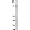 兔抗RPS6KA4(Ab-568) 多克隆抗体