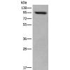 兔抗USP6NL多克隆抗体   