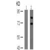 兔抗RPS6KB1 (Phospho-Ser411)多克隆抗体