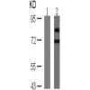 兔抗RPS6KB1 (Phospho-Ser424)多克隆抗体