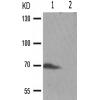 兔抗RPS6KB1(Phospho-Thr389/412) 多克隆抗体