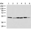 兔抗IP6K1多克隆抗体 