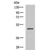 兔抗IP6K2多克隆抗体   