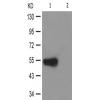兔抗RUNX1(Phospho-Ser303) 多克隆抗体