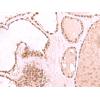 兔抗RUVBL1多克隆抗体