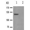 兔抗VCL(Phospho-Tyr822)多克隆抗体 