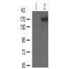 兔抗IRS1 (Phospho-Ser312)多克隆抗体 