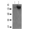 兔抗IRS1 (Phospho-Ser636) 多克隆抗体 