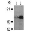 兔抗IRS1 (Phospho-Ser639)多克隆抗体 