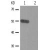 兔抗VDR(Phospho-Ser208) 多克隆抗体 