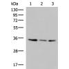 兔抗ISY1-RAB43多克隆抗体