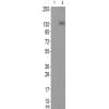 兔抗ITGB1(Phospho-Tyr795) 多克隆抗体