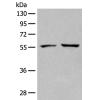 兔抗SELENBP1多克隆抗体