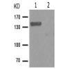 兔抗PDGFRA(Phospho-Tyr849) 多克隆抗体