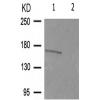 兔抗PDGFRB(Phospho-Tyr740)多克隆抗体