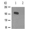 兔抗PDGFRB(Phospho-Tyr771)多克隆抗体
