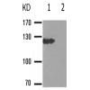 兔抗JAK2(Phospho-Tyr931) 多克隆抗体  