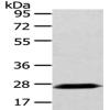 兔抗PDZK1多克隆抗体