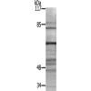 兔抗PECAM1(Ab-713) 多克隆抗体