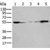 兔抗PFKFB3多克隆抗体