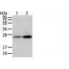 兔抗WFDC5多克隆抗体 
