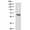 兔抗KBTBD11多克隆抗体