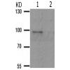 兔抗PGR(Phospho-Ser294)多克隆抗体
