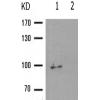 兔抗PGR(Phospho-Ser400) 多克隆抗体